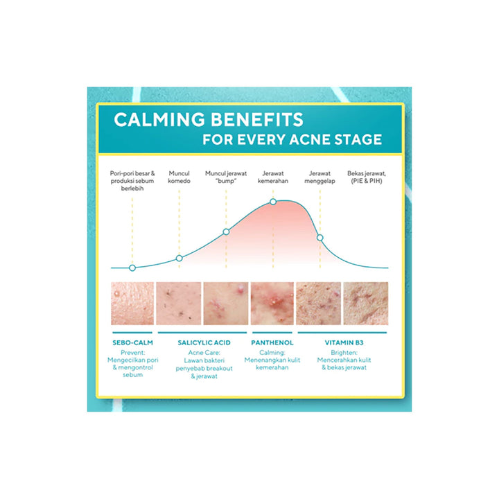 Wardah UV Shield Acne Calming Sunscreen Serum 40 ml