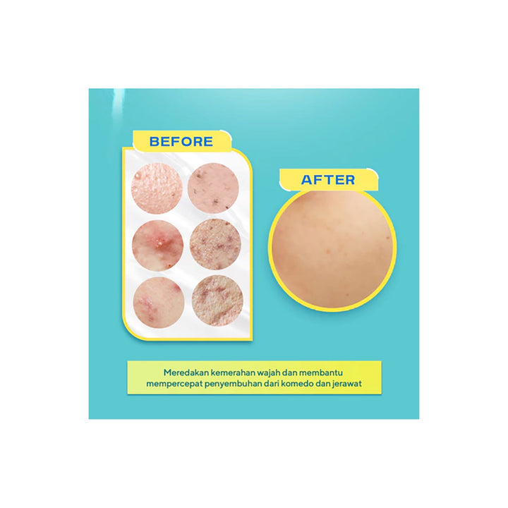 Wardah UV Shield Acne Calming Sunscreen Serum 40 ml