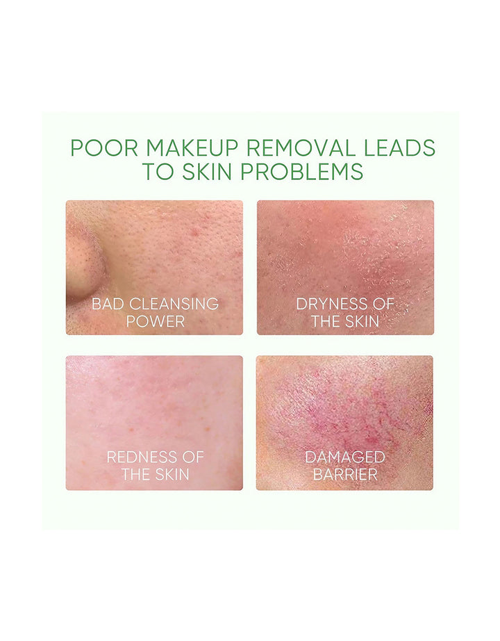 Skintific Mugwort Purifying Micellar Water 75ml