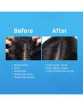 Scalperfect Soothing Serum 30 Ml