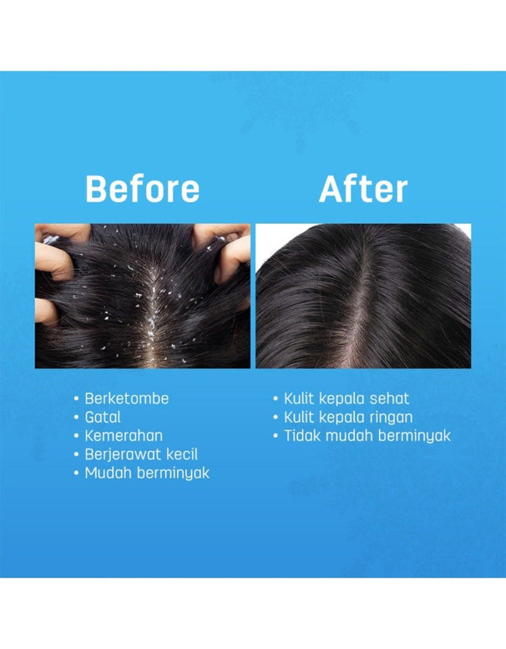 Scalperfect Soothing Serum 30 Ml