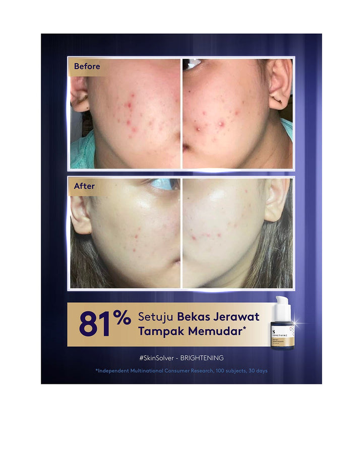 Somethinc Dark Spot Reducer Ampoule 20ml