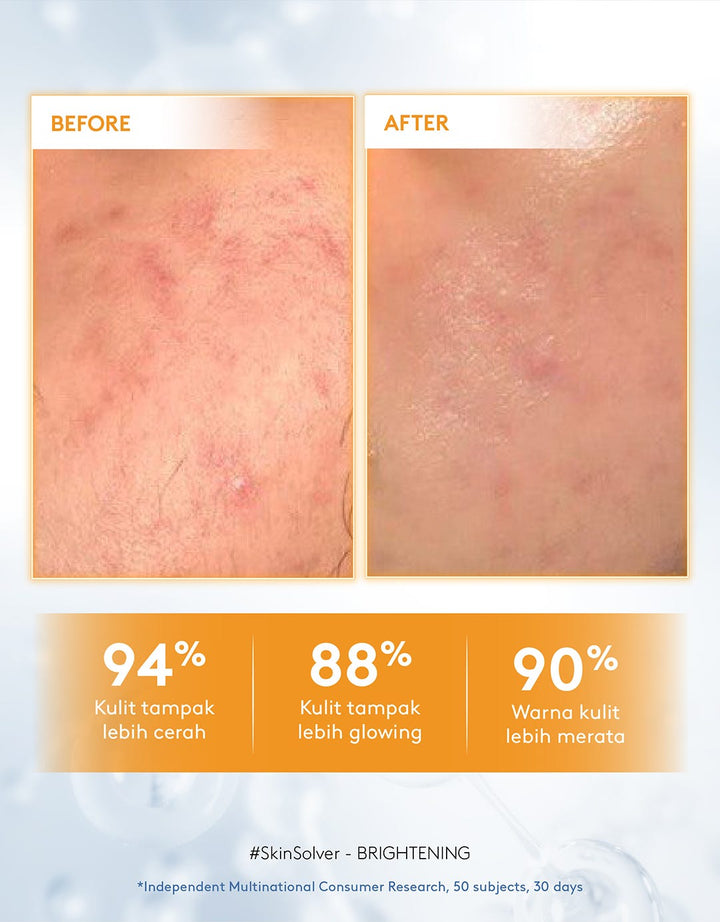 Somethinc 10% Niacinamide+Moisture Sabi Beet Max Brightening Serum 20Ml