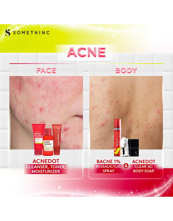 Somethinc Acnedot Treatment Moisturizer Gel 50ml