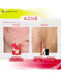 Somethinc Acnedot Treatment Moisturizer Gel 25ml