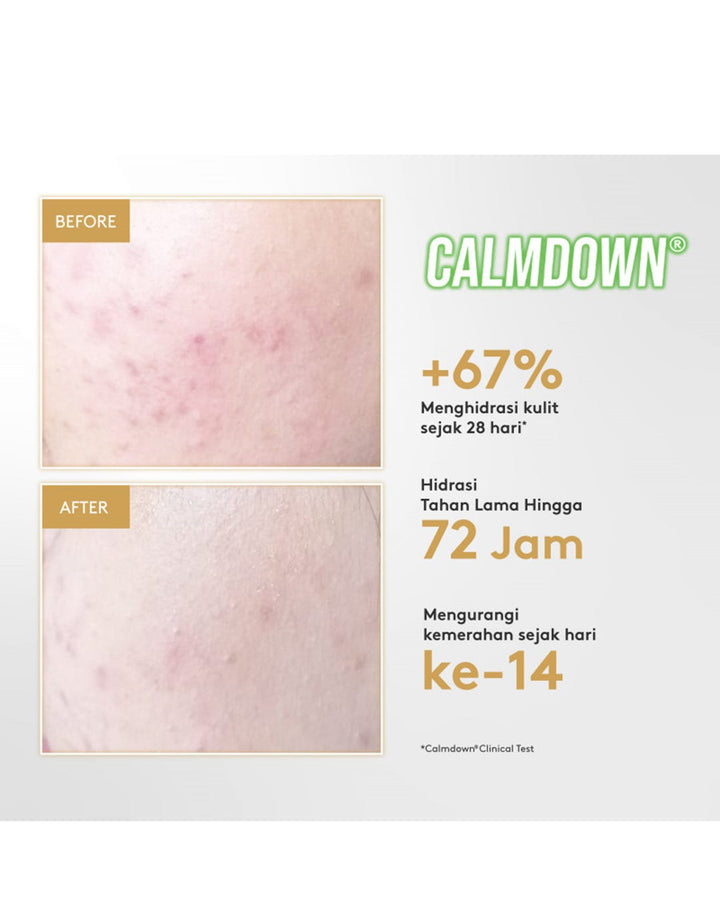Somethinc Calm Down Skinpair R Cover Cream 30Gr