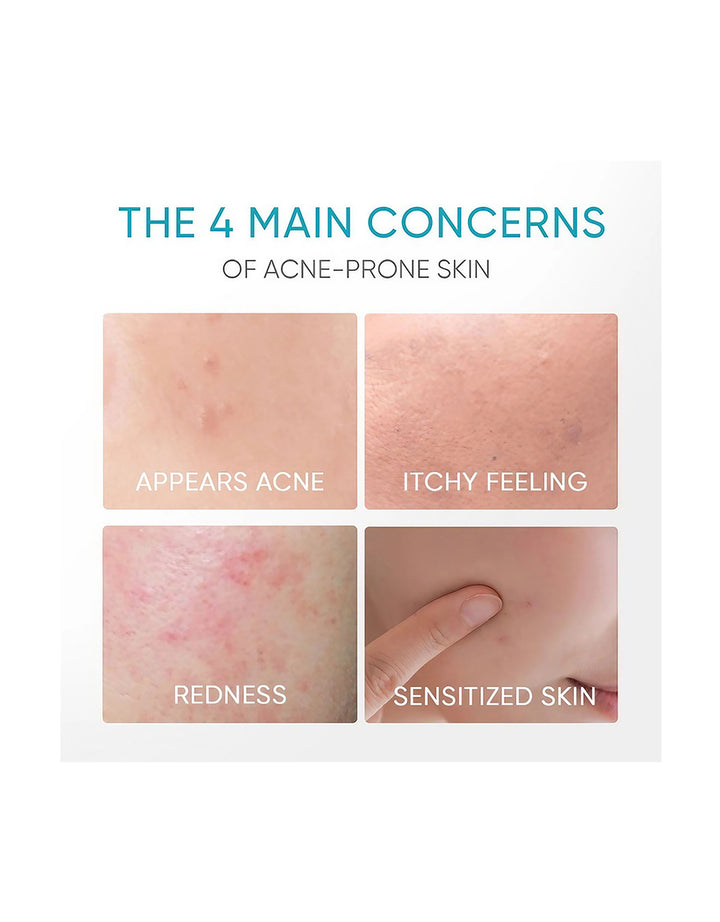 Skintific 5% Panthenol Acne Calming Water Gel Moisturizer 45g