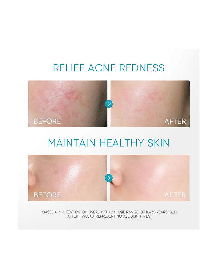 Skintific 5% Panthenol Acne Calming Water Gel Moisturizer 45g