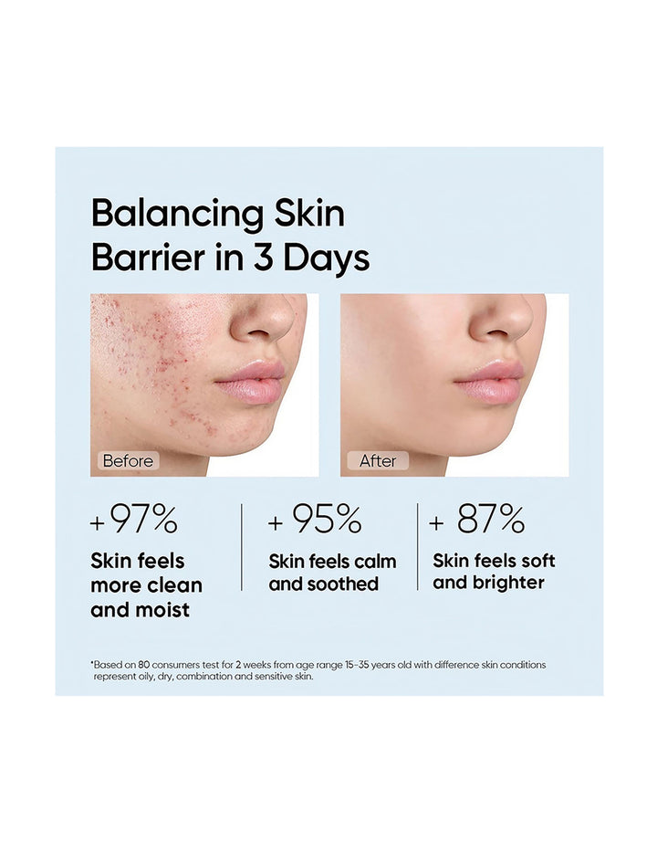 Skintific Amino Acid Ultra-Gentle 5X Ceramides Cleansing Mousse Cleanser 100ml