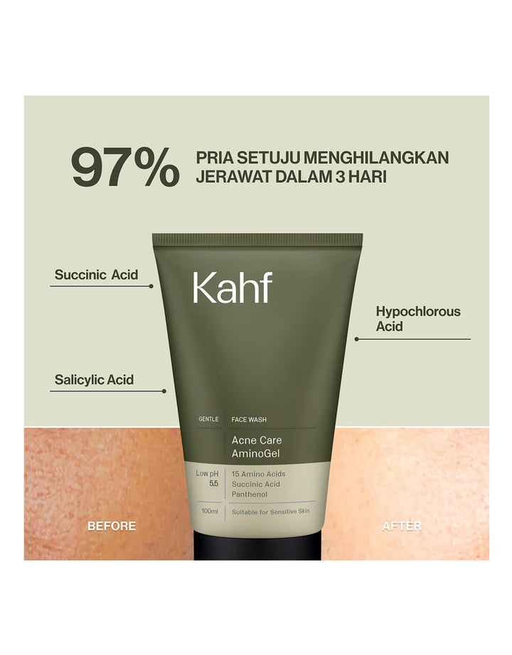 Kahf Acne Care AminoGel Face Wash 100 ml