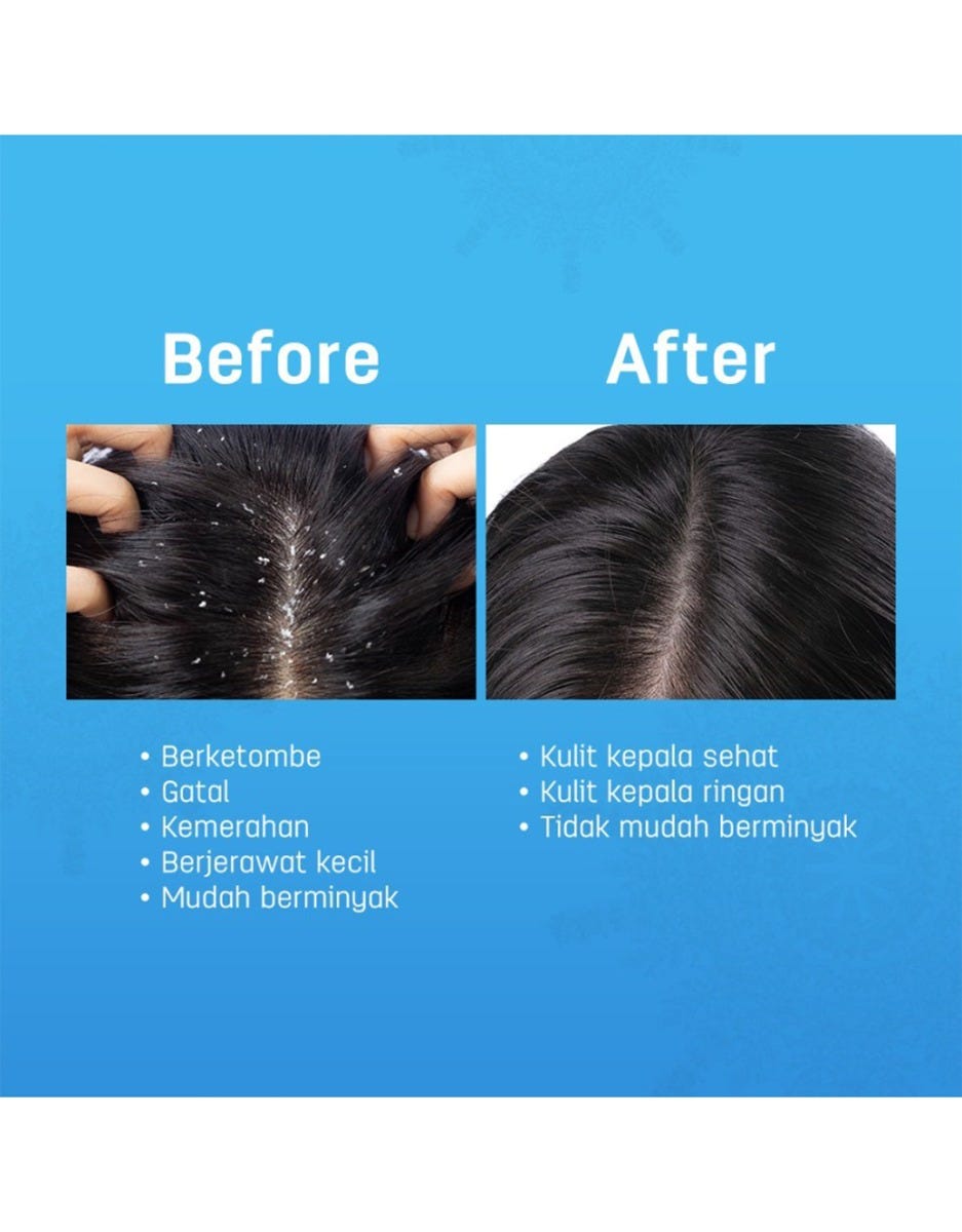 Scalperfect Soothing Serum 30 Ml