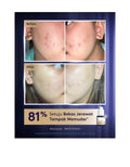 Somethinc Dark Spot Reducer Ampoule 20ml