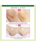 Holika Holika Smooth Skin Body Peeling
