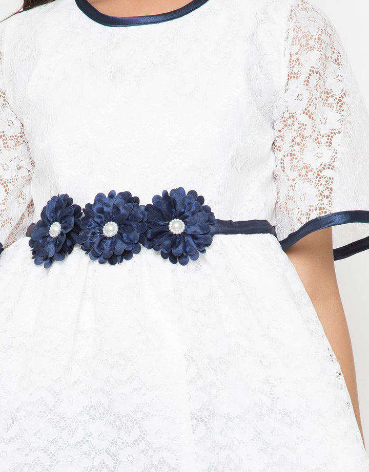 D SS FULL LACE BGA 3